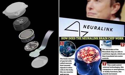 rfid chip implant brain|Elon Musk's Neuralink Has Implanted Its First Chip in a Human .